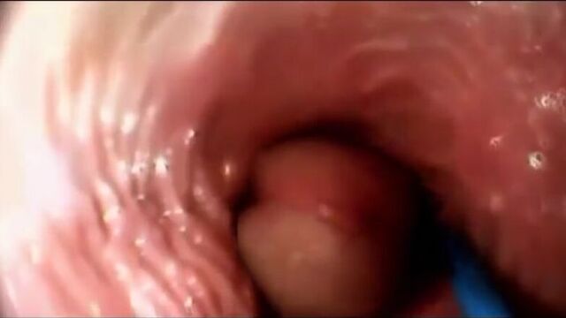 Camera inside of the vagina during sex in Missionary Position, камера во влагалище, порно, 18+, для взрослых