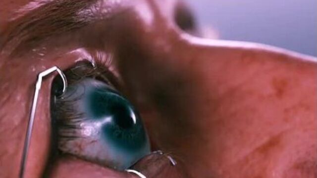 An eye for an eye